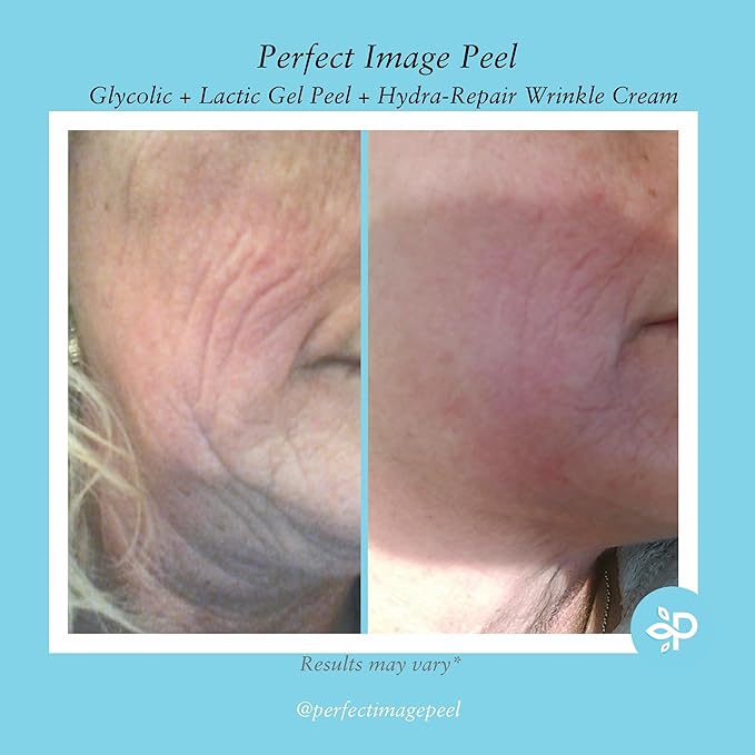 Glycolic Gel Peel - Enhanced with Retinol and Green Tea Extract (10% Strength)