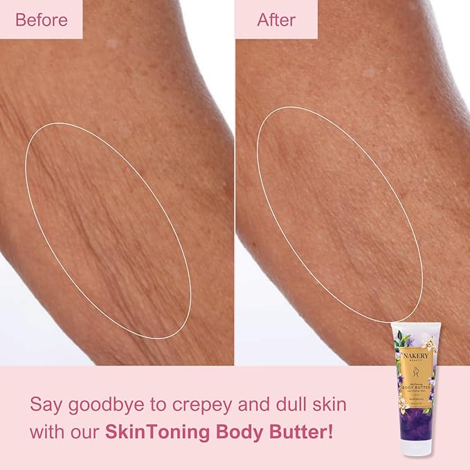 Nakery Skin Toning Body Butter for Women - Firming Body Lotion for Women - Peptide Infused Body Lotion for Crepey & Sagging Skin - Firming Lotion for Neck, Arms & Legs - Vanilla Blossoms