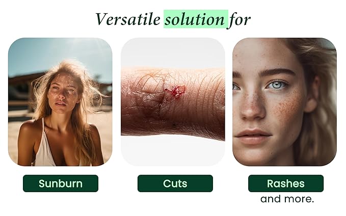 Allurials 99.75% Pure & Organic Aloe Vera Spray, Clinically tested & Dermatologist approved, Hydrates & Heals Dry & Damaged Skin & Hair- 12 Oz