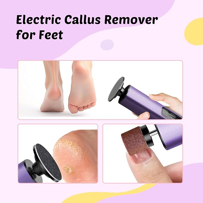 Electric Foot Callus Remover - 9-Speed with Glass Crystal Grinding Disc & Storage Box, 80/120 Grit Sandpapers (20pcs), 10 Nail Heads, Type-C Fast Charge for Dead Skin