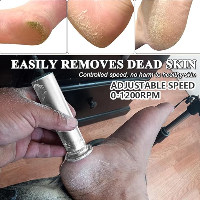 Upgraded Electric Callus Remover for Feet 1200rpm, Adjustable Speed Professional Electric Foot File Pedicure Foot Sander with 60 Replaceable Sandpaper Discs for Heel Dead Skin, Silver