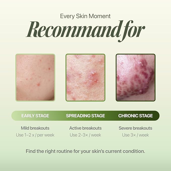 Trouble Patch Mask – Full-Face Acne & Sebum Control Sheet Mask with Tea Tree Biome, Visible Sebum Lift Results, Korean Skincare for Oily & Acne-Prone Skin | Stocking Stuffer Gift | 20ml x 4