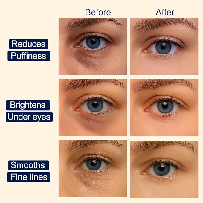 Lunara Under Eye Patches 28 Pairs, 5-Min Energizing Hydrogel Eye Masks with Caffeine Vitamin C Peptides Niacinamide, Refreshing Tired Eye, Includes Two Bonus Eye Serums, Luxury Spa Gifts for Women