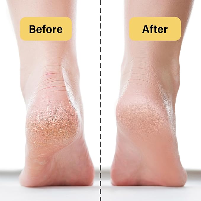 New Beef Tallow for Face,Handmade Whipped Tallow Balm with Shea Butter,Grass Fed Beef Tallow for Skin,Organic Beef Tallow Face Moisturizer,Tallow and Honey Balm for Dry & Sensitive Skin 5.07 Oz