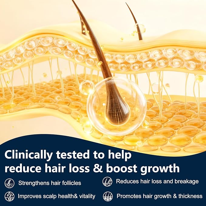 Root Activator Shampoo for Men & Women - Anti Hair Loss & Mens Hair Regrowth Shampoo with Natural Herbal Ingredients & Biotin - For Scalp Health & Cooling Sensation, 10.1 Fl Oz /300ml