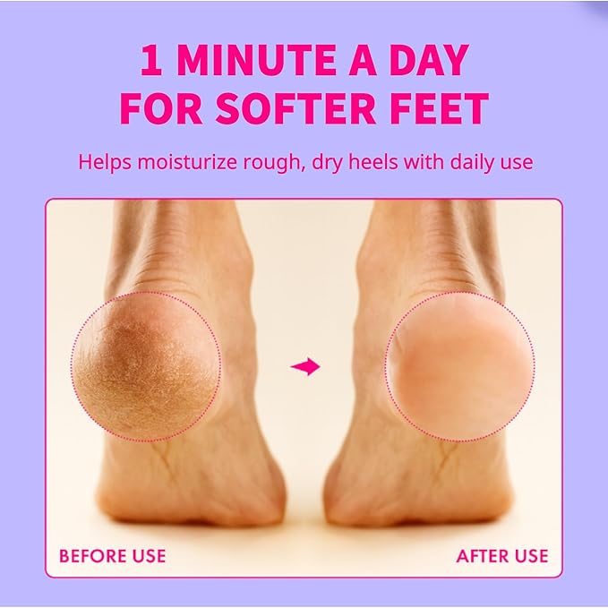 Foot Care Deodorant Lotion – Long-Lasting Odor Control & Deep Hydration, Neutralizes Foot Odor, Moisturizes Dry, Cracked Heels, Mushroom Extract Formula for Soft, Healthy-Feeling Feet, 1.76oz