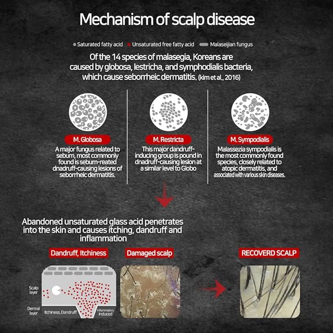 Biotin and Zinc Pyrithione Shampoo - Combats Itching, Dandruff, Seborrhoeic Dermatitis & Sebum Buildup | Scalp Care Solution | 300ml 10 oz