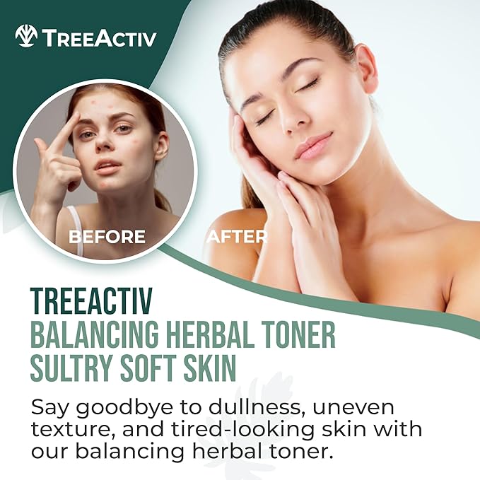 TreeActiv Balancing Herbal Toner | Facial Skin Moisturizer | Witch Hazel | Rose Water | Clary Sage | Tea Tree | Natural Astringent | Alcohol-Free | Reduce Oily Face Acne | Men, Women, Teens | 4 fl oz