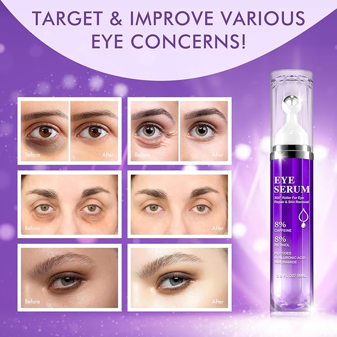 Eye Serum with 8% Caffeine, Hyaluronic Acid, Niacinamide & Peptides for Dark Circles, Puffy Eye Bags, Wrinkles Fine Lines, Anti Aging, Under Eye Treatment Cream with 360° Massage Roller-Ball