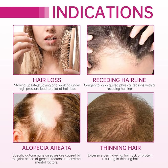 Onion & Biotin Shampoo Set – Rosemary Strengthening Shampoo + Conditioner + Leave-in Hair Vitamin Capsules, Hydrating & Repair Kit for Dry, Damaged, and Frizzy Hair