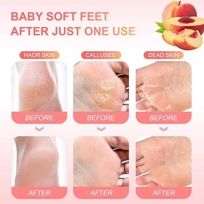 Foot Peeling Mask Exfoliant for Peeling Off Calluses, Natural Exfoliator for Dry Dead Skin, Callus, Repair Rough Heels Soft Smooth Touch