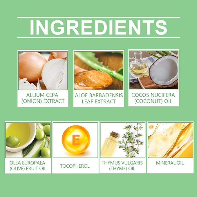 Nourishing Onion & Aloe Vera Hair Oil for Smoothing and Shine - Moisturizing Hair Treatment for Dry, Damaged Hair, Supports a Healthy-Looking Scalp and Hair Appearance (1 Pack)