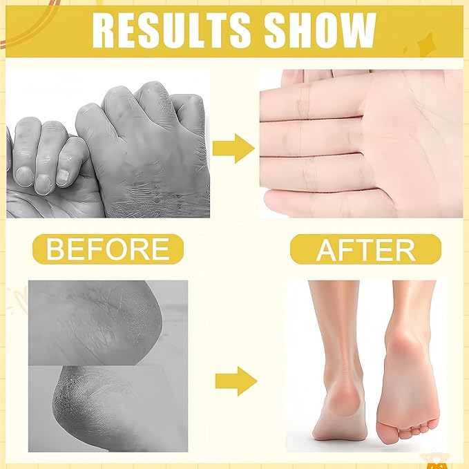 Turmeric Foot Cream, Hydrating & Softening Hand and Foot Cream Balm Stick, Hand and Foot Cracked Heel Stick Moisturizer, Heel Cream for Women Men & Girls, Balm for Dry Elbows, 1.41 Oz 1Pc