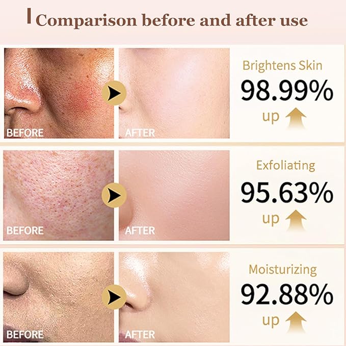 Rice Peel Shot Glow Rice Ampoule Duo | Pore Minimizing Gentle Peel & Deep Hydration |Black Rice Exfoliant for All Skin | 6.76 Fl Oz 2Pcs