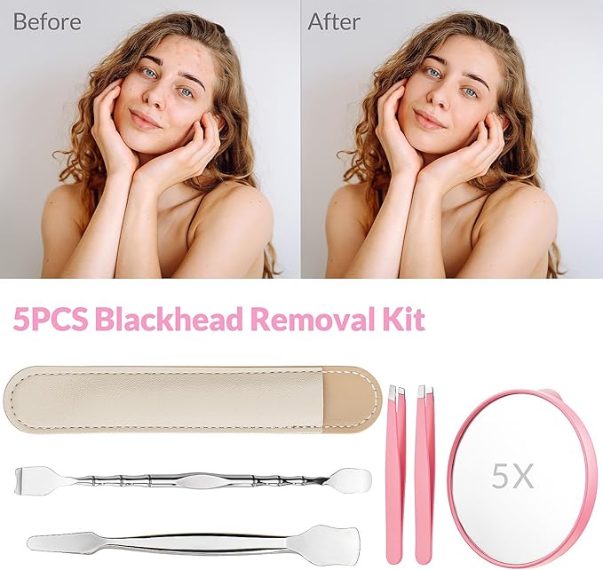 Blackhead Remover Tools Kit 5PCS: 2 × Blackhead Spatula Skin Tools, 2× Eyebrow Tweezers, 1 × 5X Mirror, Pore Prep Tool Pore Scraper, Stainless Pimple Extractor Tweezer Kit for Face & Nose (Pink)
