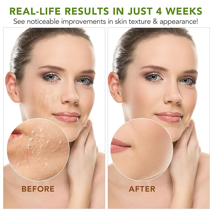 Shea Butter Raw Organic,Pure Shea Butter Unrefined for Body, Face & Hair,Long-Lasting Hydration for Dry Skin, Hair Care, DIY Lip Balm, Natural Moisturizer-100% Natural Vitamin A, E & F-7.8 oz