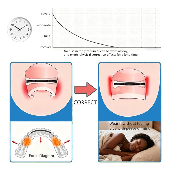 10-Piece Pack Titanium Alloy Ingrown Toenail Corrector,Curved Toenail Repair Patch,Memory Metal Ingrown Toenail Physical Correction Tool,Ingrown Toenail Removal Tool Set,Nail Aesthetic Shaping Tools.