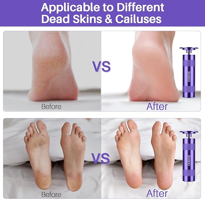 Electric Foot Callus Remover, 2-in-1 Electric Foot Filer/Nail Filer, Callus Remover for Feet with 60Pcs+12Pcs Sandpaper Discs，Holiday Gift Foot Repair Tool, Purple