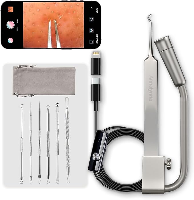 Luma 1 Visual Blackhead Remover Tweezers with Camera - Pimple Popper Tool with Camera 20x Magnification, 1080P, 8 LED Lights, with Blackhead Remover Pimple Popper Tool Kit (6 Piece Kit),Titanium