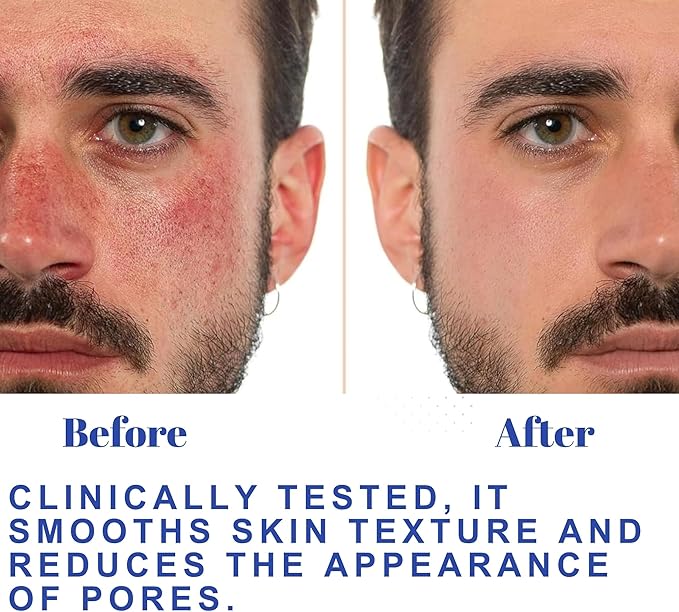 Hydrating Toner for Face, Refreshing Face Mist | Rose Water Toner with Witch Hazel Salicylic, & Glycolic Acid | A Zero Pore Cleanser, Helps Fade Dark Spots & Minimize Pores, Alcohol-Free, 100 ml