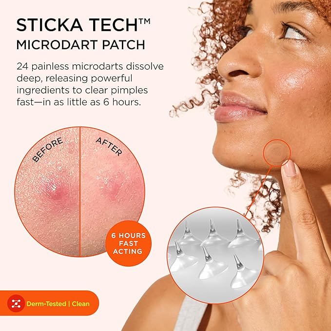 ZitSticka Killa Acne Patches for Face - World's Most Potent Pimple Patch with Fast-Acting Microdarts - Starts Working within 2 Hours for Deep, Early-Stage Zits - 20 Count