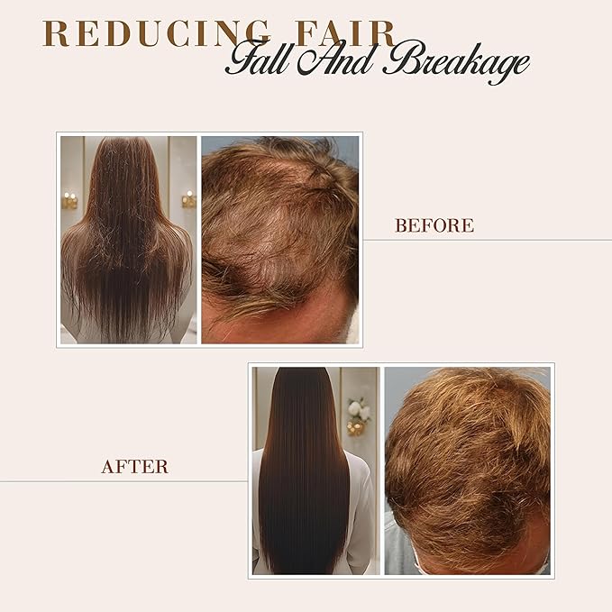 Natural Wunderz Castor Hair Oil, Supports Hair Growth, Thickening Serum and Moisturizing Scalp Treatment for Dry and Damaged Hair, Sulfate Free and Vegan Friendly, 4 Fl Oz