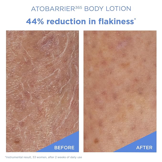 AESTURA ATOBARRIER365 Korean Body Lotion with Ceramides | Fast-Absorbing Moisturizer for Dry, Sensitive & Eczema-Prone Skin | Non-Comedogenic, Fragrance-Free, 400 mL / 13.5 fl oz