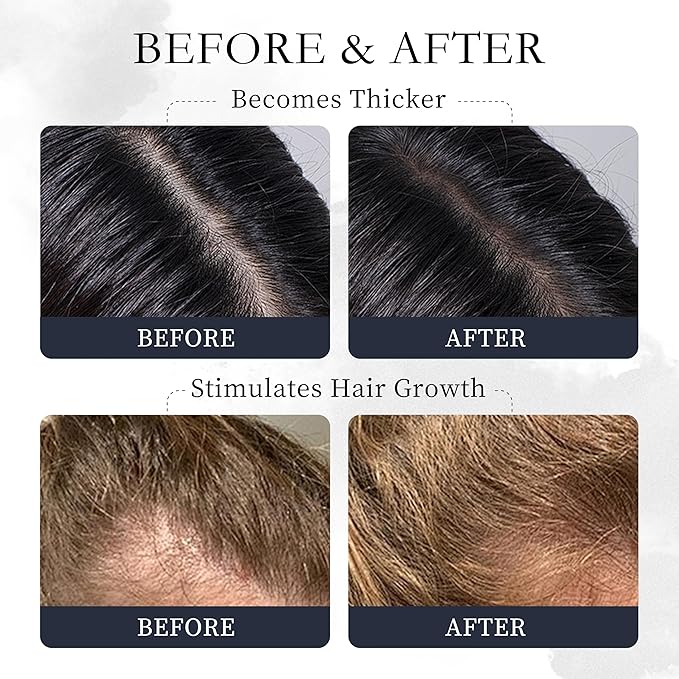 Rosemary Hair Oil – Dry Scalp & Split End Treatment with Biotin & Essential Oils for Strengthening, Nourishing, Moisturizing & Supporting Longer, Healthier Hair