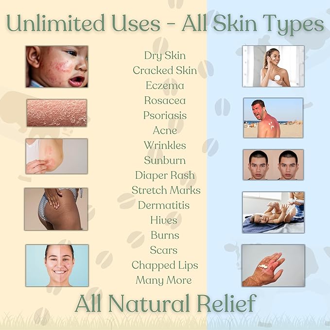 Beef Tallow Balm for Skin | NAKED TALLOW BALM | 1 Ingredient - 100% Grass Fed Tallow | Whole Body & Face Moisturizer | Whipped & UNSCENTED for Sensititve Dry Skin, Babies, Eczema, Psoriasis(2oz)