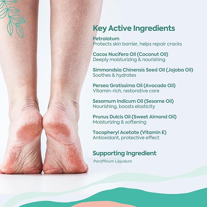 Foot Moisturizing Cream – Hydrating Heel & Foot Cream with Vitamin E and Avocado Oil – Softens Dry, Rough Skin – Nourishing Daily Foot Care, 100 ml