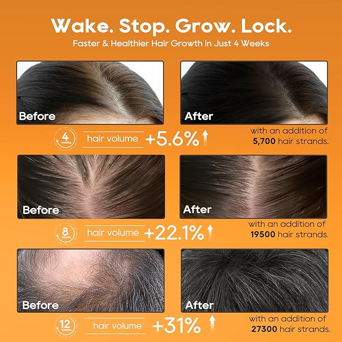 Women‘s Hair Growth Serum Oil, 100% Natural Herbal Extracts, Root Revive Visibly Thickening Fuller Hair, Follicle Stimulator Scalp Serum for Hair Loss/Shedding,Thin, Dry & Damaged Treatment