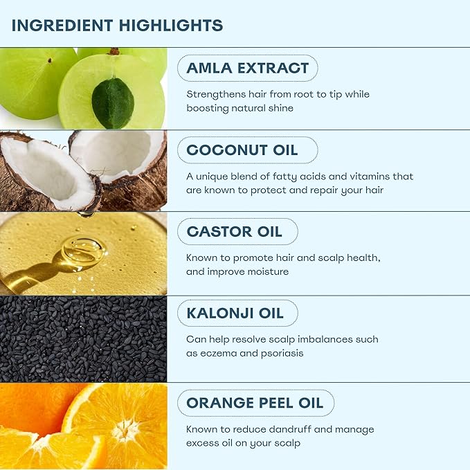 Squigs Hair Growth Oil for Dry & Damaged Hair – with Amla, Castor & Coconut Oil Blend for Frizz Control, Hydration & Scalp Treatment – Pre-Wash & Styling Treatment – 130ml