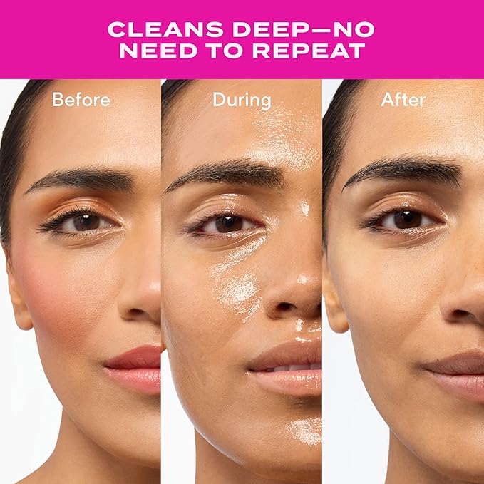 Murad Lipid-Enriched Double Cleansing Balm - Hydrating Balm-to-Oil Face Cleanser & Makeup Remover – Removes Long-Wear Makeup & SPF – Barrier Repair with Ceramides & Camellia Oil – 1.7 Fl Oz