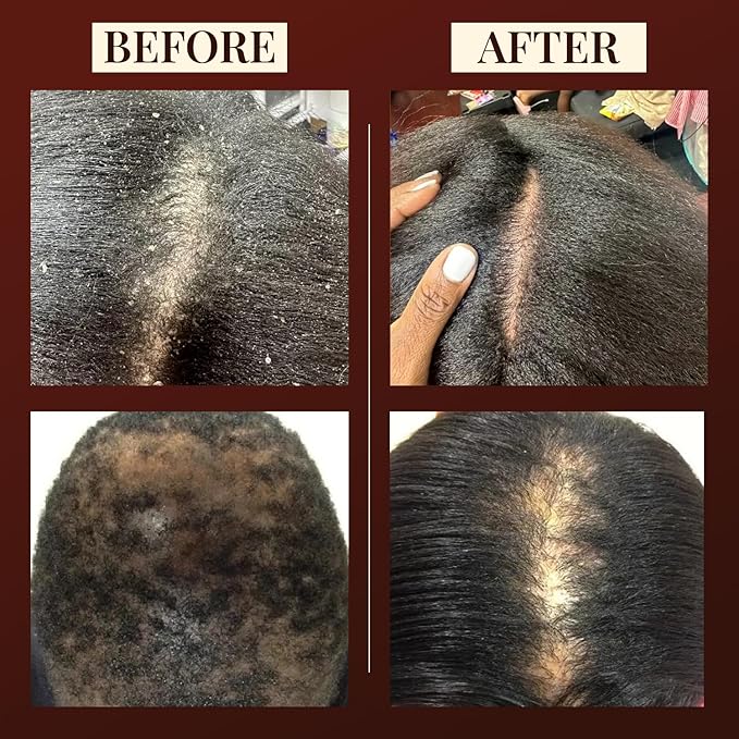 100% Pure Batana Oil - Nourishing Hair & Skin Treatment for Growth, Strength & Moisture- Batana Oils for Soft, Shiny Hair & Glowing Skin- Oil for Daily Use- Restores Hairs & Skins Naturally