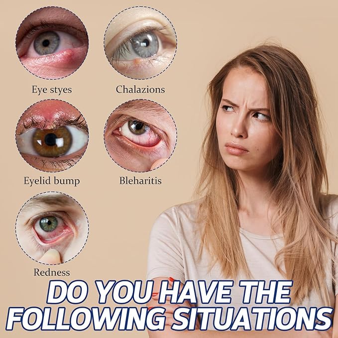 Stye Eye Treatment, Chalazion Treatment Serum, Stye & Blepharitis Remover with Hippophae Rhamnoides Fruit, Helichrysum Angustifolium Flower & Persea Gratissima Oil (1 Fl. OZ (Pack of 1))