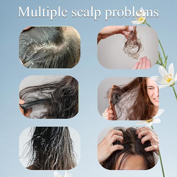 Trichology Shampoo | Anti-Hair Fall & Less Shedding & Volumizing Shampoo | Biotin, Arginine & Oleanolic Acid Strengthens Roots Promotes Hair Growth Oil Control & Scalp Nourishment 300ML (1PCS)