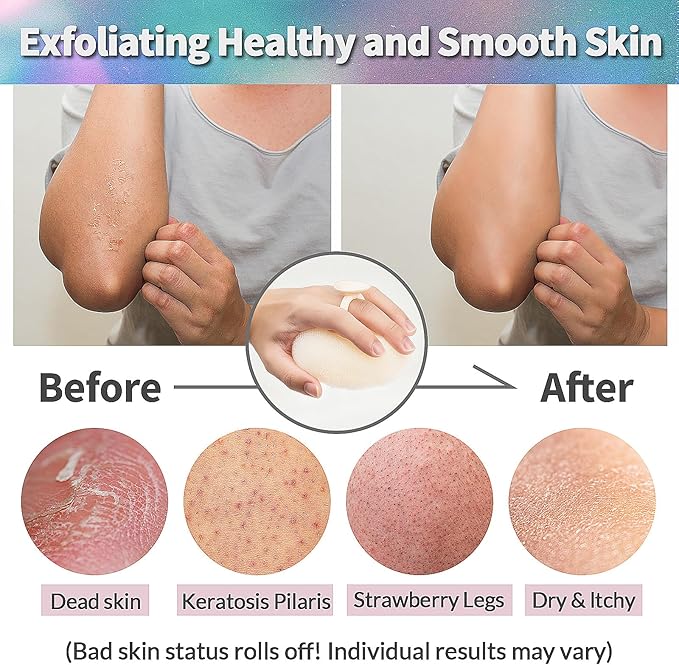 Deep Exfoliating Bath Set 3PCS: 2 Super Soft Sunflower Suction Cup Bath Balls, & 2-in-1 Long Exfoliating Shower Towel, Body & Back Scrubber Exfoliator, Body Massage Scrub & Shower Loofah Sponge