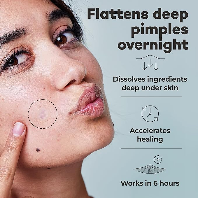 OMMA 144 Patches Pimple Patches for Face and 36 Microdart Acne Patch Bundle