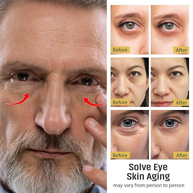 UOG (United One) Eye Serum Complex – Rapid Reduction Eye Serum for Dark Circles, Puffiness, Wrinkles & Crow’s Feet | Anti-Aging Formula for Firm, Youthful Eyes | Hydrates & Smooths (20ml / 0.7oz)