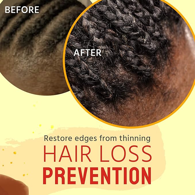 Glammed Naturally Scalp Oil for Dry Itchy Scalp - Includes Castor Oil for Hair, Dandruff, Locs, Tension Relief Hair Oil Applicator for Scalp Care 4 oz