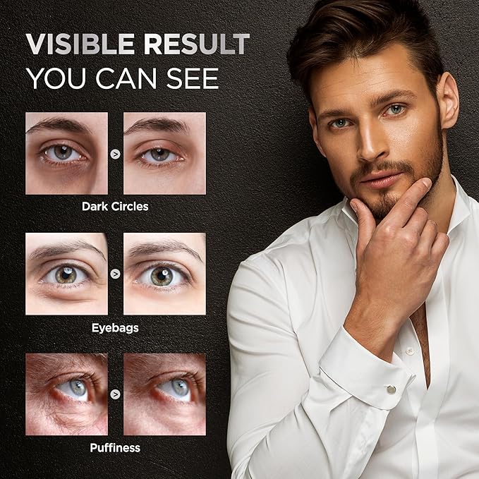 Under Eye Cream for Puffiness and Bags: Caffeine Serum Roller for Dark Circles Treatment - With 5% Caffeine Retinol Hyaluronic Acid Niacinamide Peptides 0.5 fl. oz (Medium, Unscented)