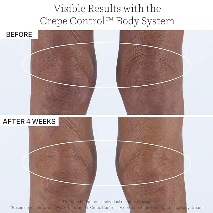 StriVectin Tighten & Lift Crepe Control Exfoliating Body Scrub, Targets Crepiness and Rough, Dull Skin, 5 Fl Oz, white