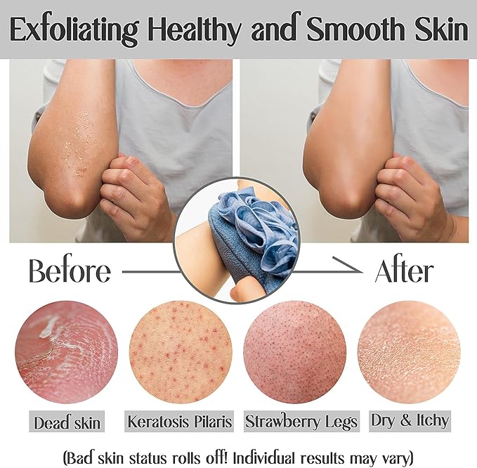 Deep Exfoliating Mitt Double-Sided Glove for Shower, with Long Exfoliating Washcloth Towel - Extreme Body & Back Scrubber Exfoliator, Body Massage Scrub & Bath Shower Loofah Sponge (2-Blue)