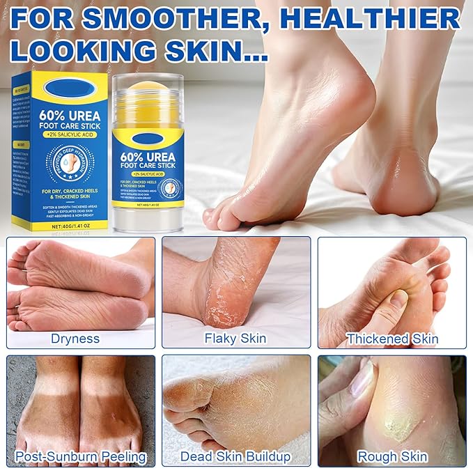60% Urea Foot Cream Stick with 2% Salicylic Acid, Extra-Strength Cracked Heel Repair for Dry Feet & Calluses, Moisturizing Urea Cream Stick for Dead Skin Removal, Heel Balm for Rough Skin(2pcs)