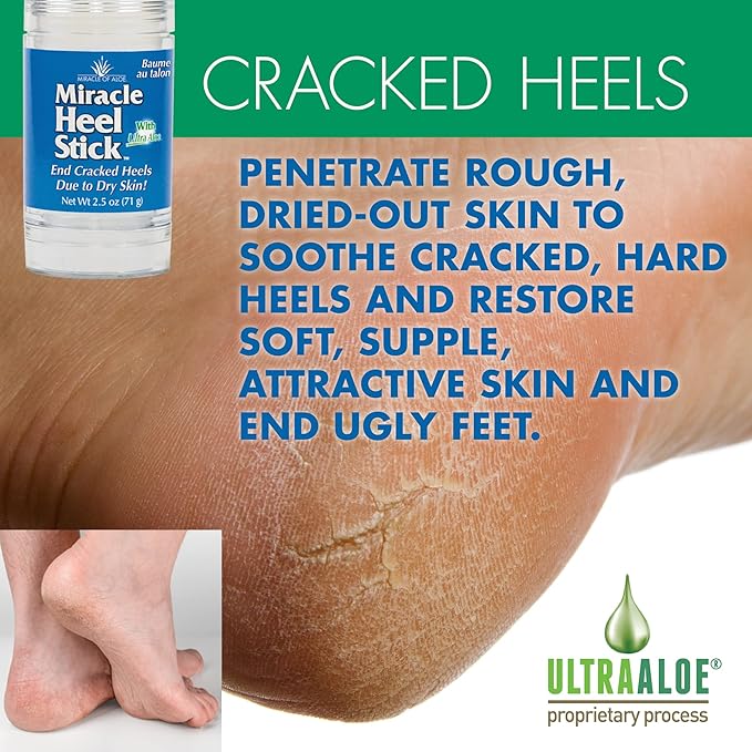 Heel Balm for Dry Cracked Feet - Miracle Heel Stick for Cracked Heel Repair - Heel Balm Stick for Cracked Heel Treatment - Formulated with Pure Aloe Vera, Tea Tree Oil, Shea & Cocoa Butters | 2.5 oz