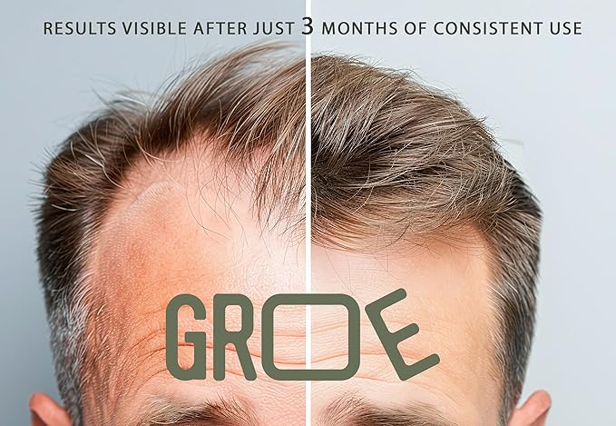 GROE ROSEMARY Anti-Thinning Biotin Hair Growth Shampoo (16.6oz) Natural & Vegan, Sulfate-Free, CLINICALLY TESTED Effective Results, Women & Men