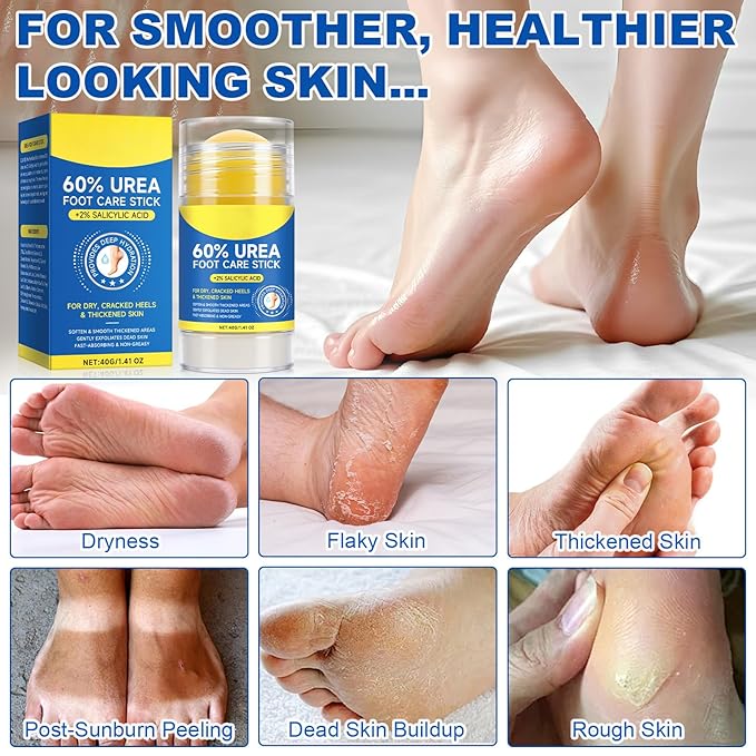 60% Urea with 2% Salicylic Acid Urea Foot Care Stick, Cracked Heel Repair & Deep Moisturizing Treatment for Dry, Rough, Balm for Heels, Elbows, Knees & Hands, Exfoliating Dead Skin, Softening Skin
