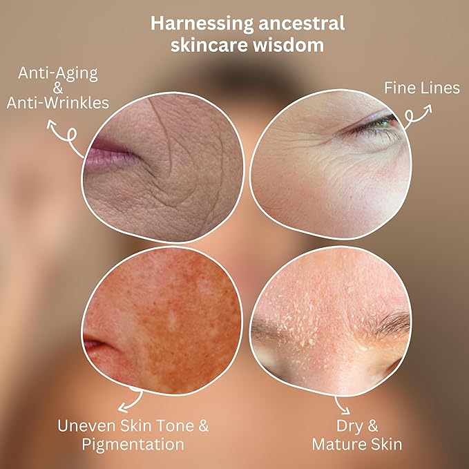 Whipped Tallow Honey Balm – Grass-Fed Beef Tallow infused with Organic Manuka Honey, Rosehip, Jojoba & Olive Oils – Nourishing Face, Neck & Body Lotion, 100% Organic (Frankincense Scent - 2 oz)