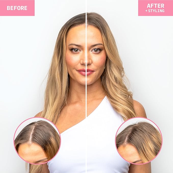 FoxyBae Dry Shampoo Duo Kit - with Biotin - Dirty Gal and Turned Up - Refreshes, Volumizing, Absorbs Oil - for All Hair Types - 2 x 7 Fl Oz