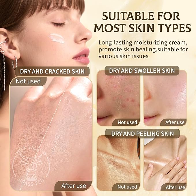 Beef Tallow for Skin，Natural Grass-Fed Beef Tallow and Honey Balm for Face & Body，Whipped Moisturizer for Most Skin Types and Sensitive Skin(60g/2.1oz)